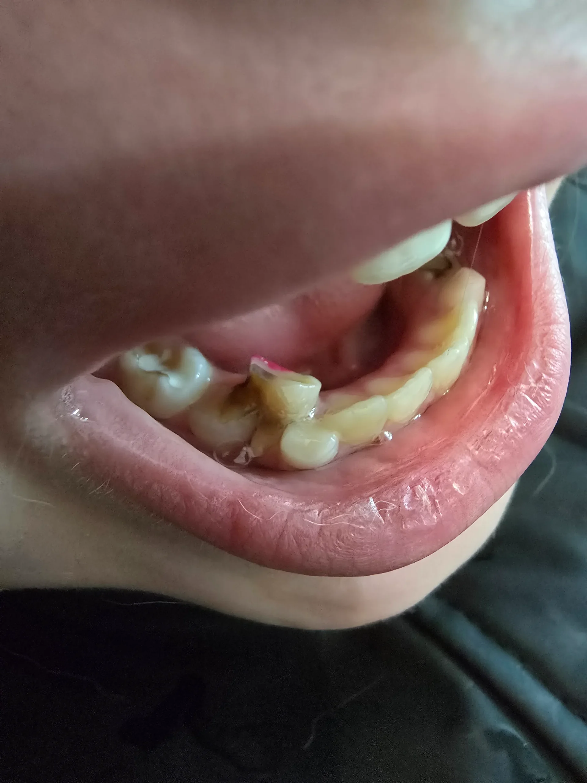 Дитяча стоматологія — клініка Ваша Усмішка