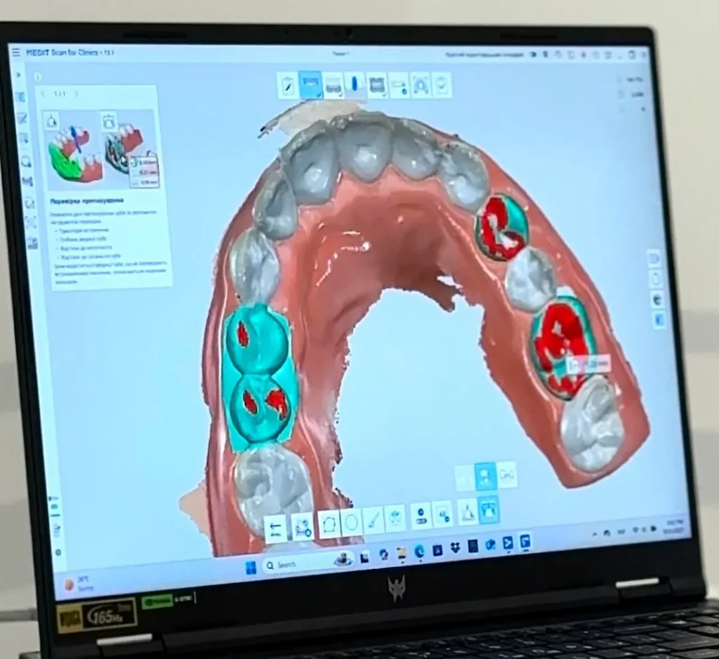 3D-сканер зубів у стоматології «Ваша Усмішка»